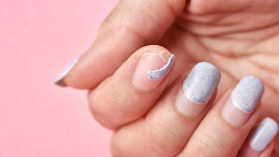 פטרת ציפורניים על הידיים